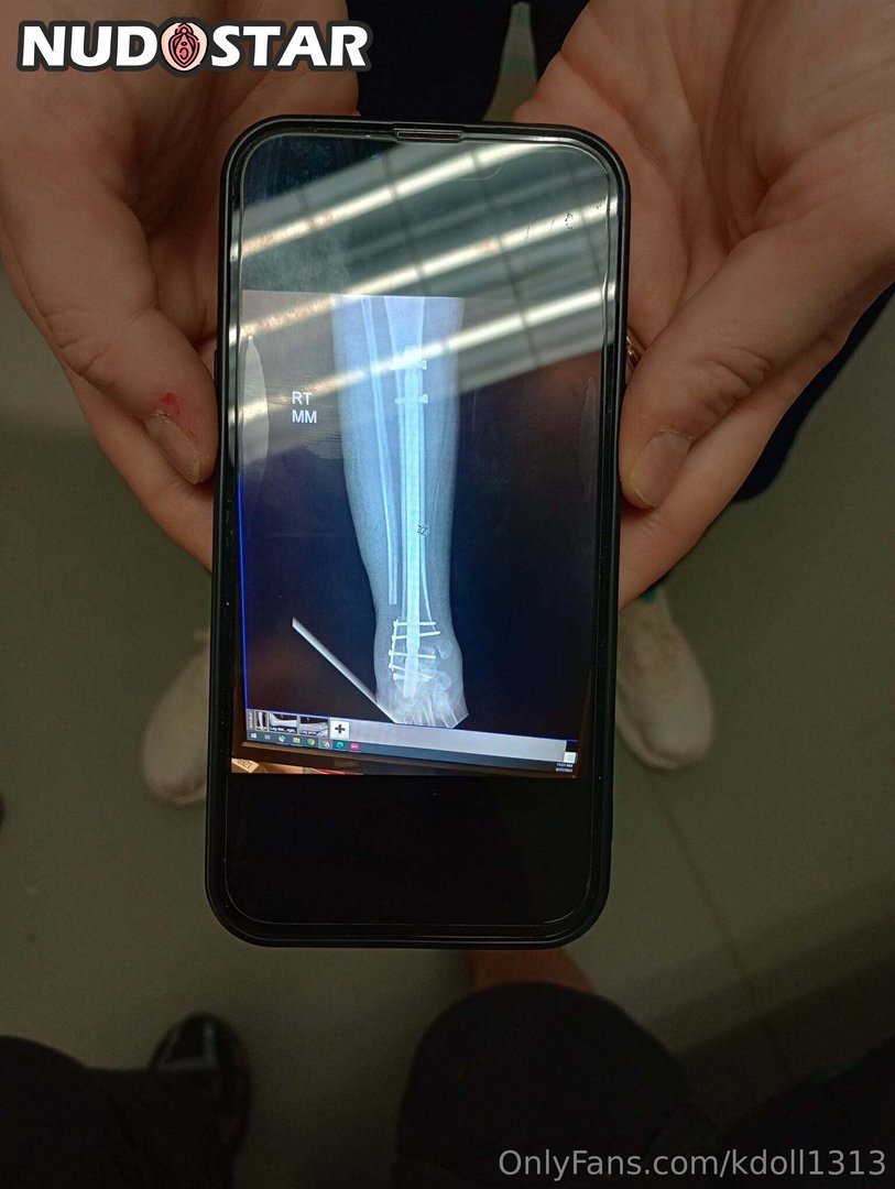 Kdoll1313 Leaked Photo 8