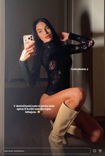 Anet Slotova Nude Leaks OnlyFans Photo 7