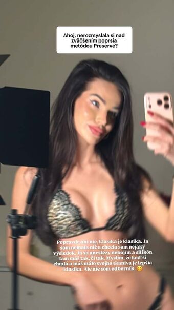 Anet Slotova Nude Leaks OnlyFans Photo 6