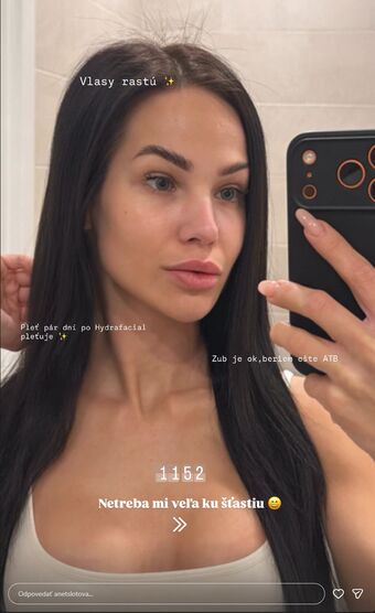 Anet Slotova Nude Leaks OnlyFans Photo 8