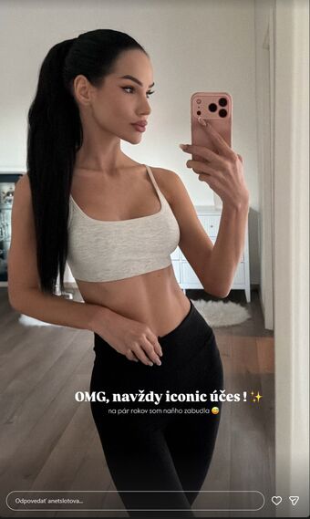 Anet Slotova Nude Leaks OnlyFans Photo 5